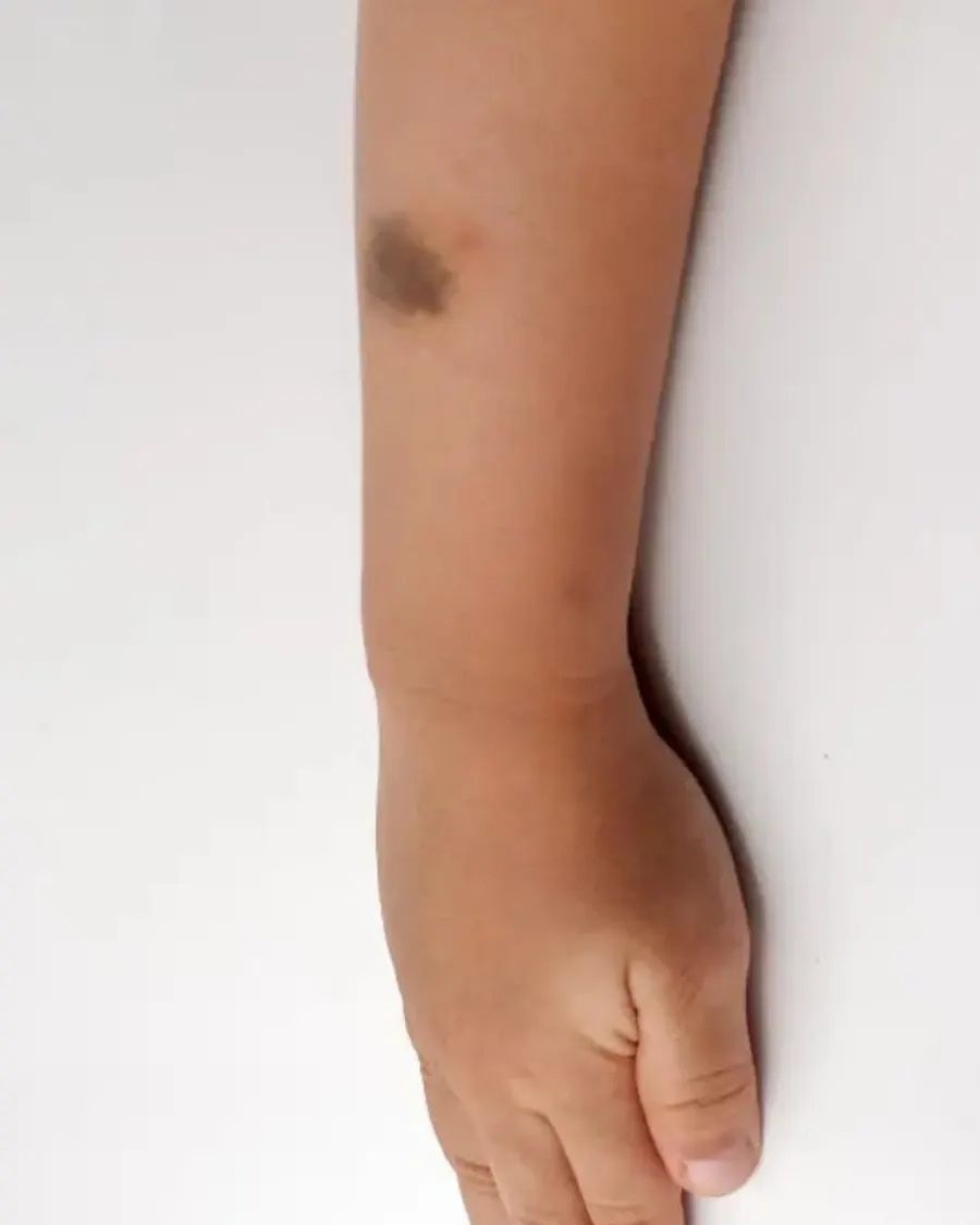 Specialized Pediatric Dermatology Care at Cinch Clinics